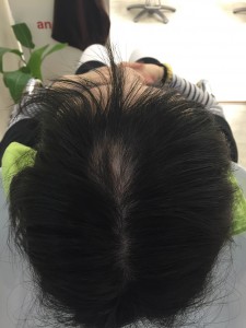 2015年12月17日 (4)